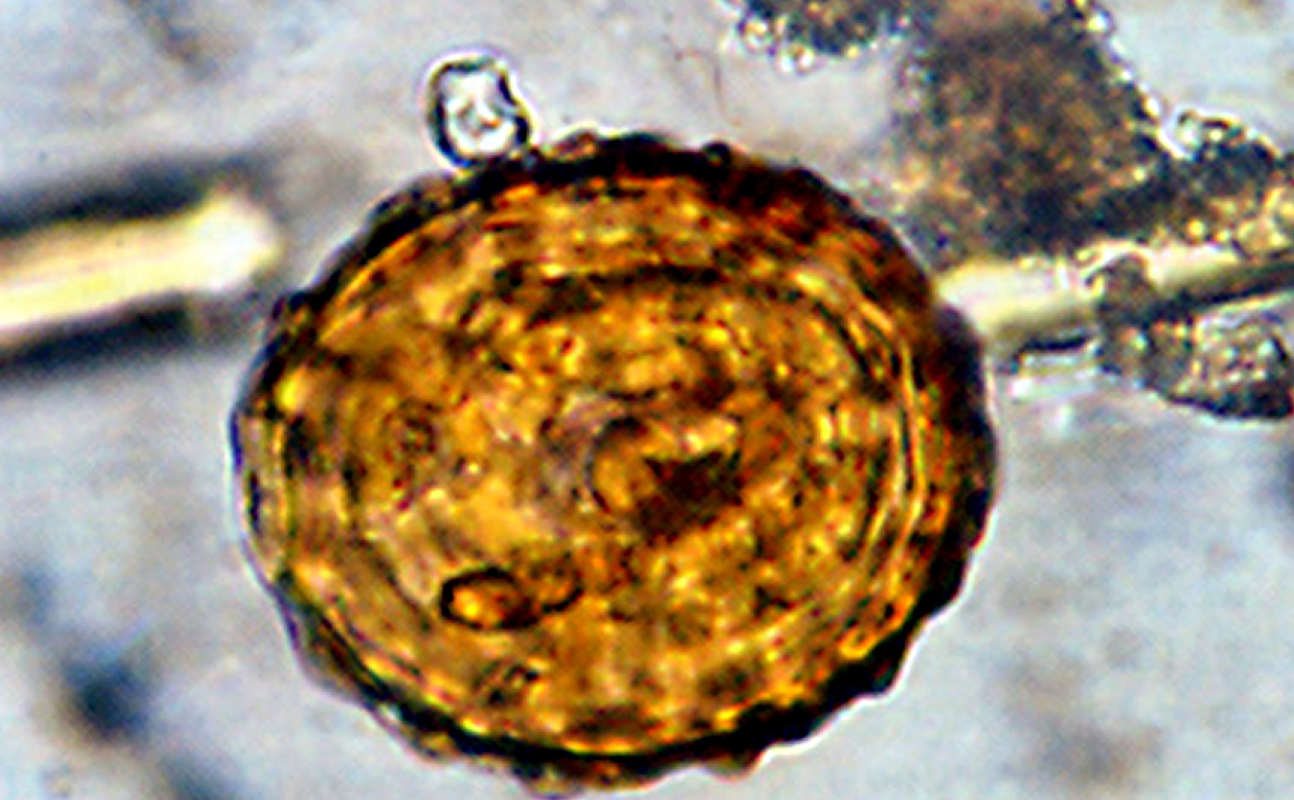 Galeria pesquisa: estudos de parasitologia.